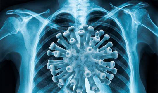 lungs covid19