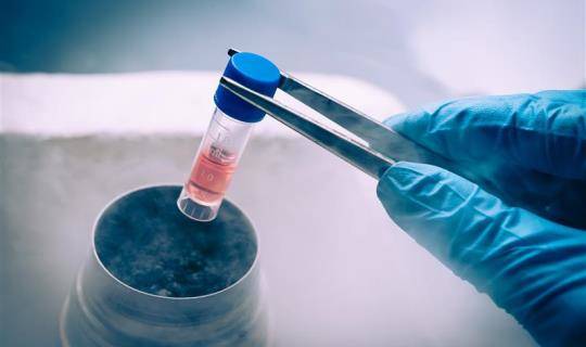 Cell and gene therapy cryogenic vial