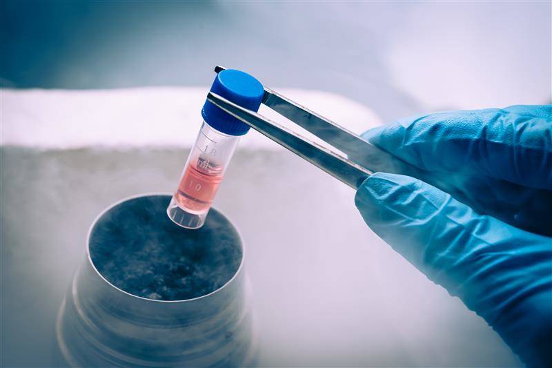 Cell and gene therapy cryogenic vial